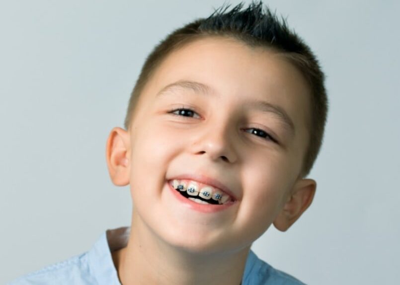 Braces in Kingston