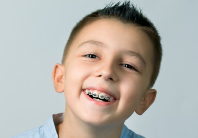 Braces in Oak Ridge