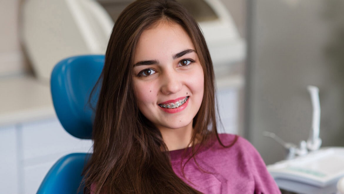 Types Of Braces